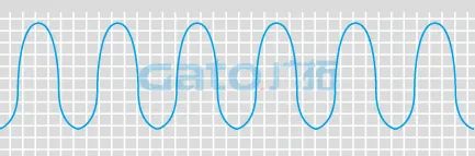干貨|太全了，振動光纖7大場景的安裝方式圖文詳解！(圖21)